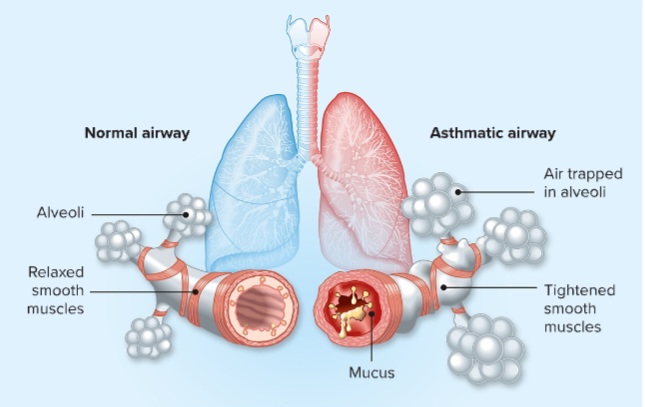 Advertisement Image